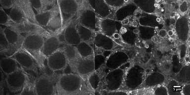 Allen Cell Collection