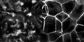 [object Object] thumbnail