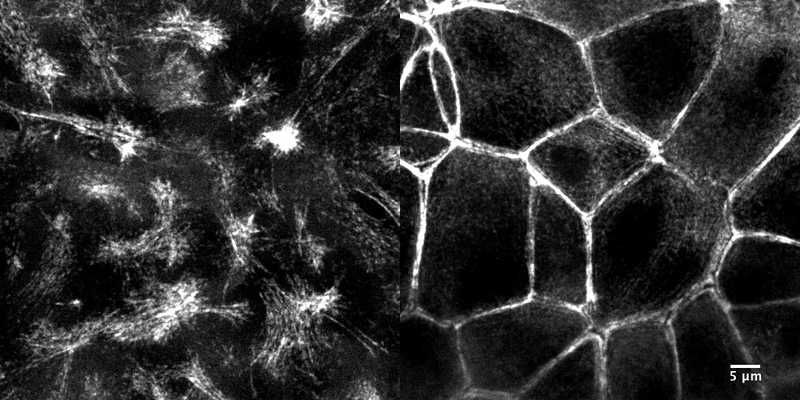 Allen Cell Collection