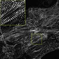 Cell Line Thumbnail