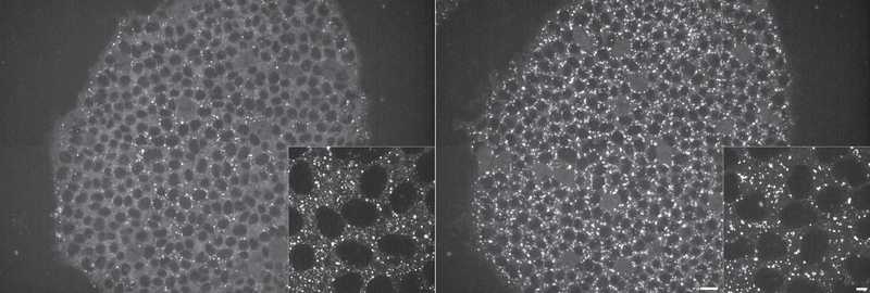 Allen Cell Collection